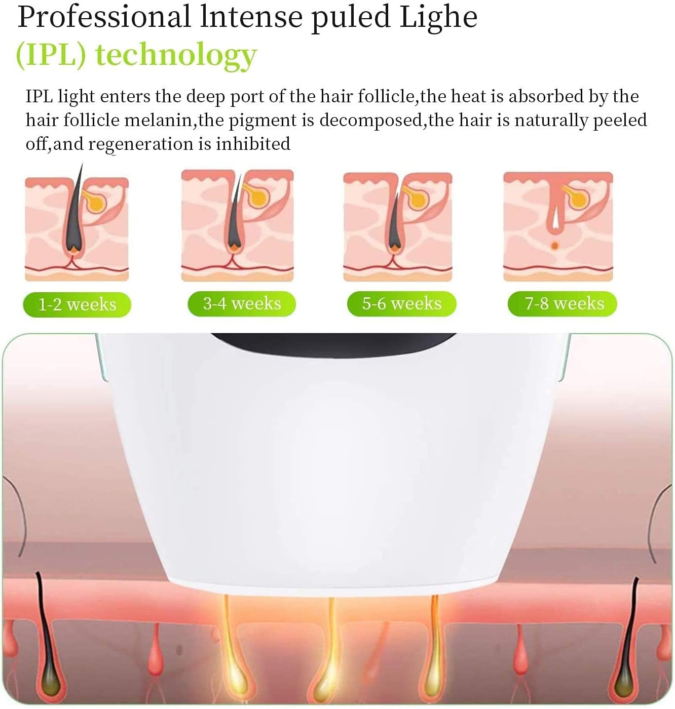 IPL Hair Removal System      نظام إزالة الشعر IPL